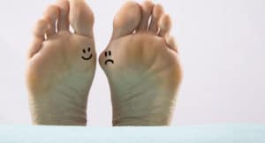 a close up bunion feet