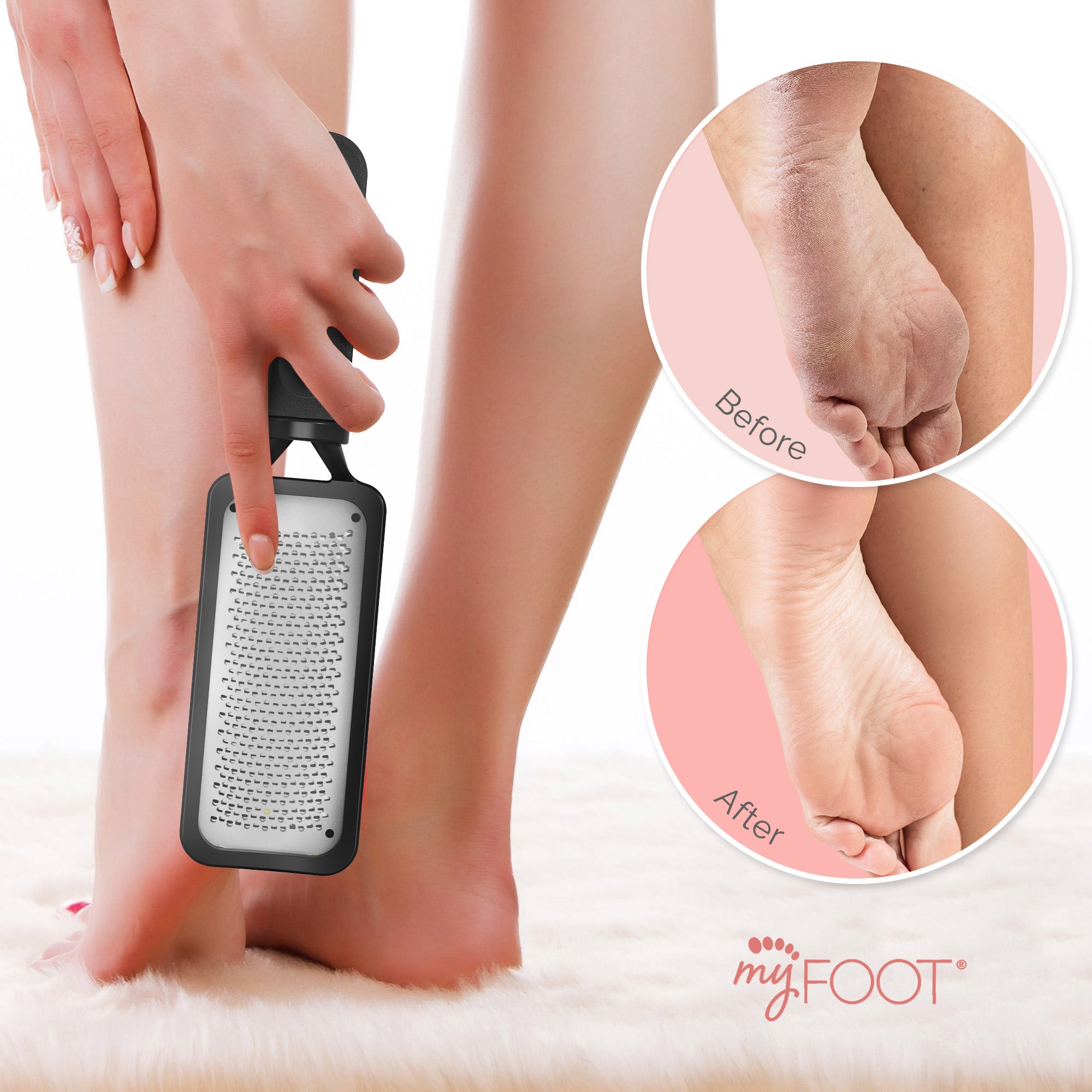Foot Rasp Foot File and Foot Scrubber. Best Pedicure Tools Callus Remover for Feet , Feet Scrubber Dead Skin& Foot Care Can Be used on Both Wet and